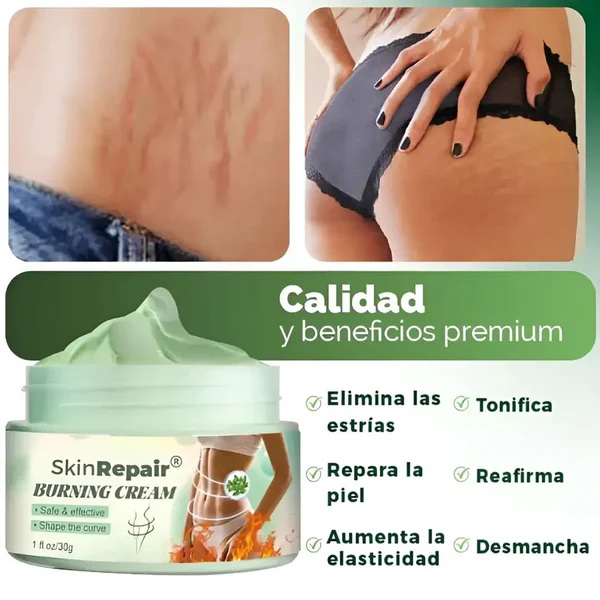 Crema Antiestrías SkinRepair 3 | Reafirma, Tonifica y Ayuda a Reducir Estrías